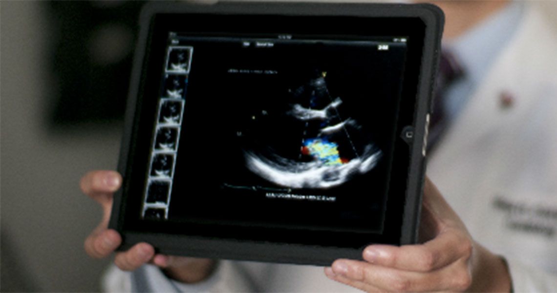 A doctor holds an iPad displaying ultrasound images