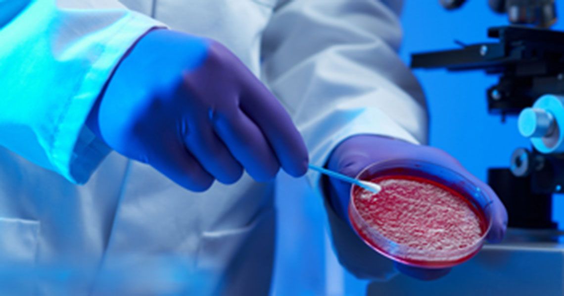 A person in lab gloves and a white coat placing a swab on a red petri dish