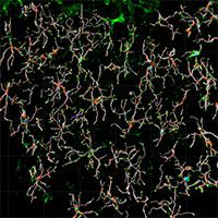 3D reconstruction of microglia filaments in the brain subfornical organ