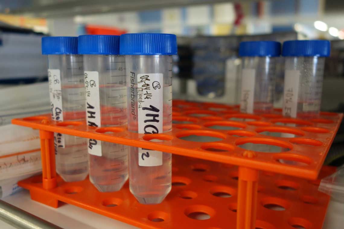 Vials in a lab