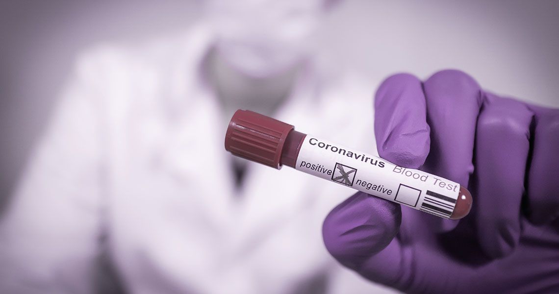 A laboratory scientist holding a covid-19 sample vial