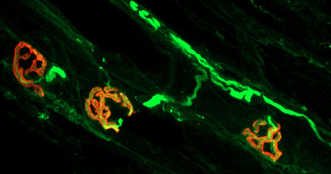 Neuromuscular junctions - the red is the muscle endplate and the green is the motor nerve