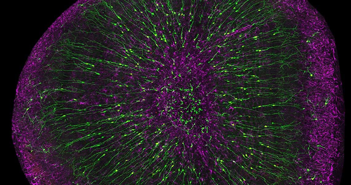 Purple and green olfactory bulb interneurons and astrocytes in the brain