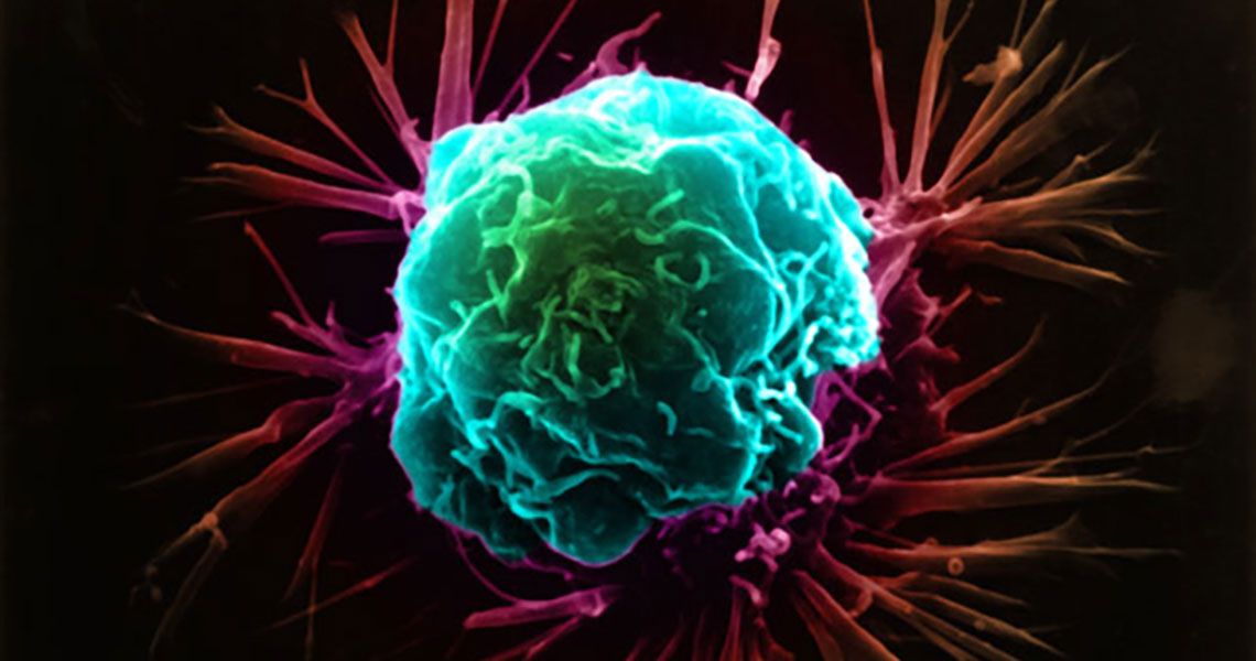 A blue and red breast cancer cell illustration