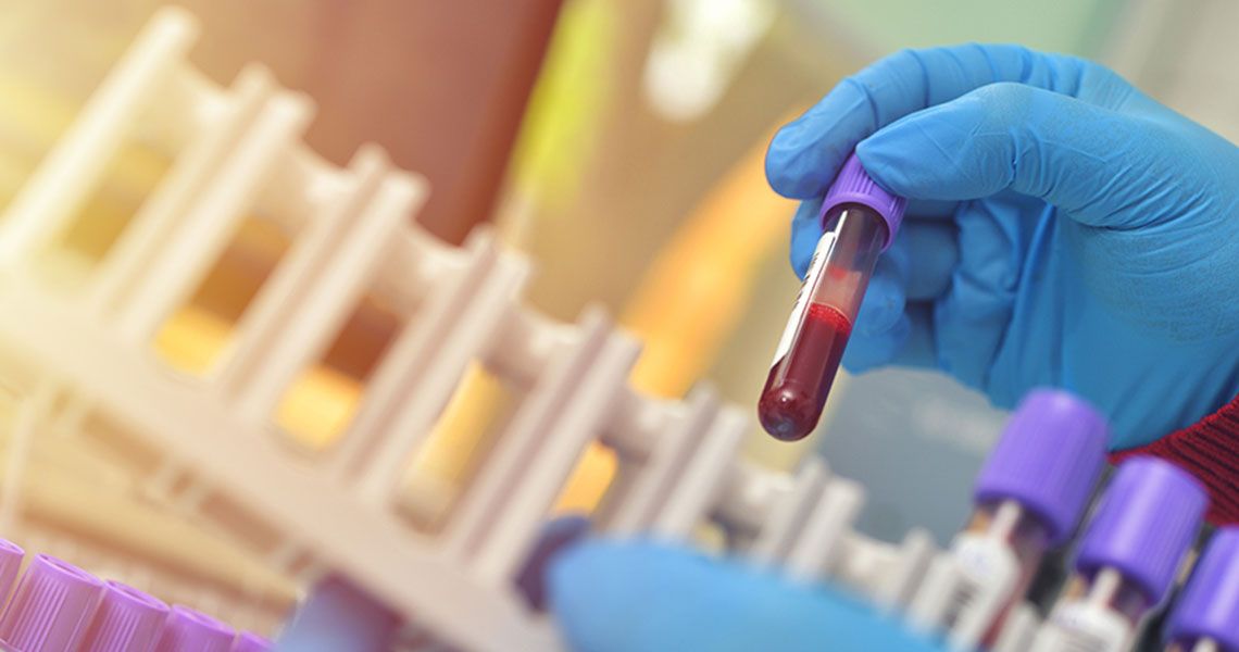 A gloved hand placing a blood-filled vial into a vial rack