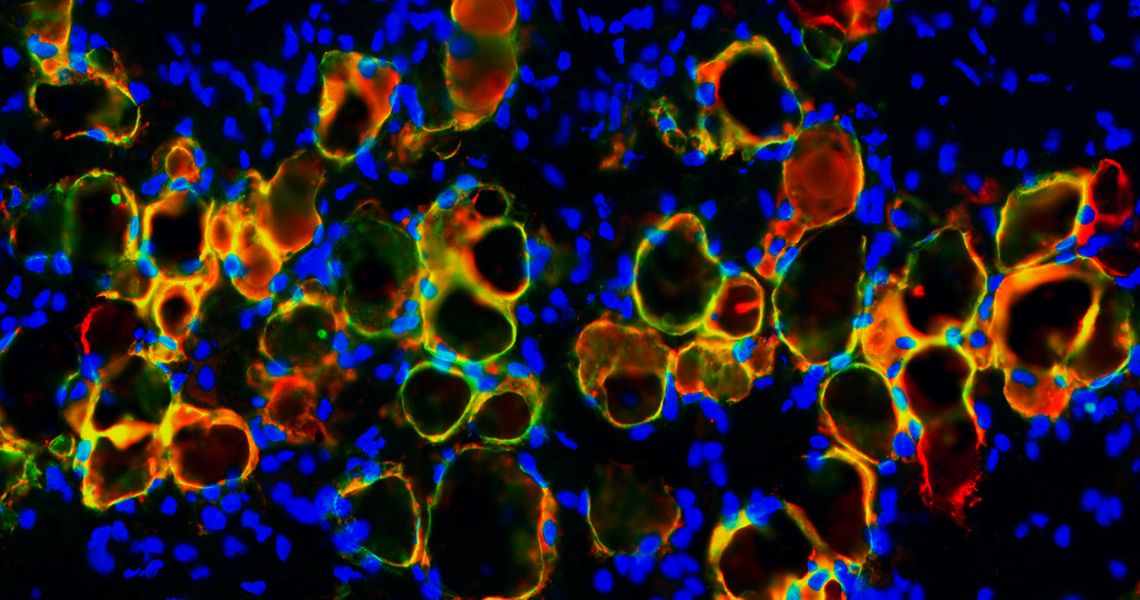 Grand Prize image Adipocyte cells 