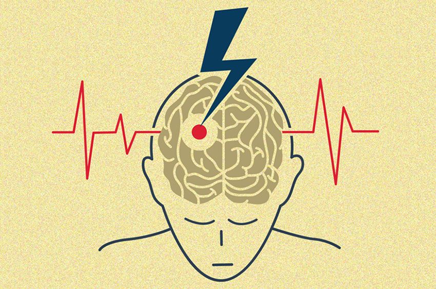 A see-through view into a person's head where a lighting bolt strikes part of their brain