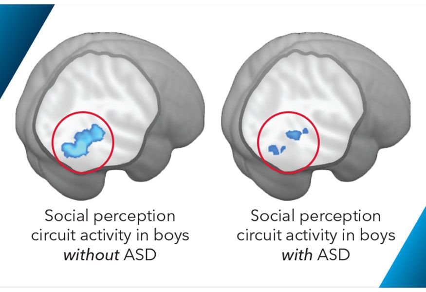 Two brain diagrams showing a higher social perception circuit activity in boys without ASD versus those with ASD