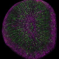 Olfactory bulb interneurons (green) and astrocytes (magenta) in the brain