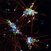 Human iPSC-derived motor neurons