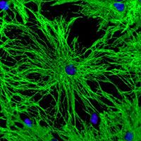 Astrocytes (green) and nuclei (blue) in the central nervous system