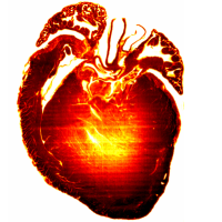 D2-mdx Dystrophic Mouse Heart