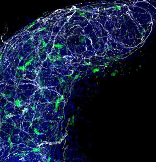 3-D confocal image of the tip of a prostate lobe that presents as a blue curve with green and white wisps