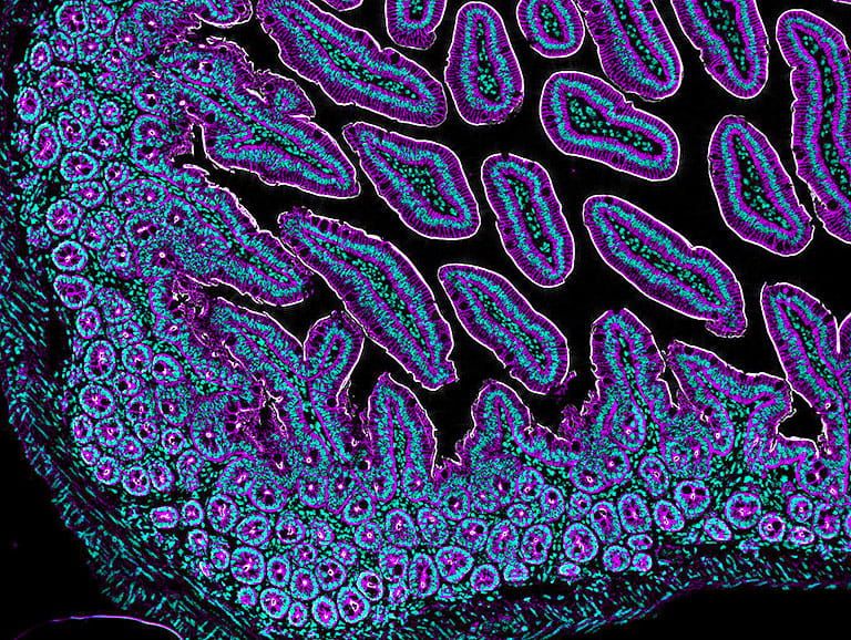 A 20X immunohistochemistry of murine small intestine embedded in paraffin, which presents as a vibrant purple and blue