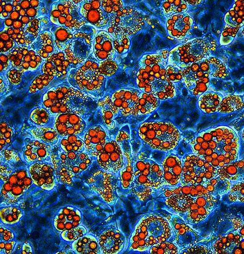 3T3-L1 fibroblasts that appear as blood orange circles against a vibrant blue ocean-like background