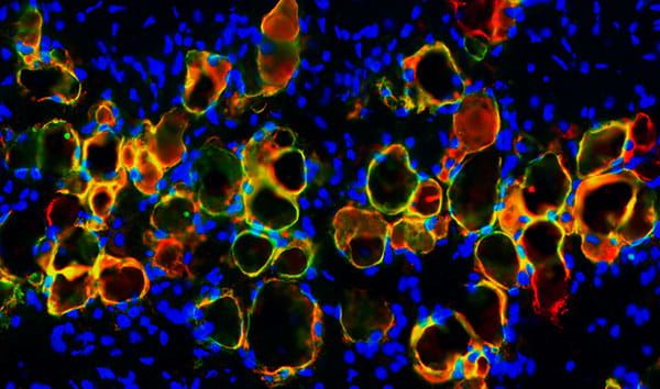 Adipocyte cells (red) with activated Cre (green)—and co-staining as yellow—in a transgenic model