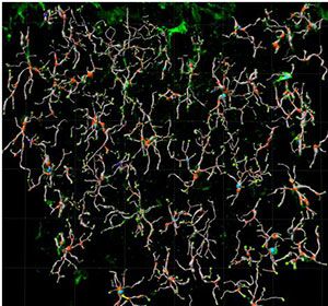 Microglia Filaments as a 3D reconstruction