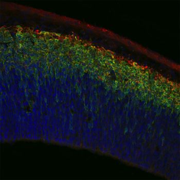 Neurons derived from basal progenitor stem cells in the cortex represented in blue, green yellow, and red light