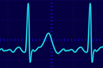 Waveform lines from a heart monitor reading