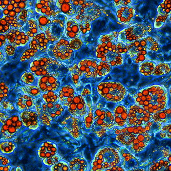 fibroblast cells by Sarah Kleb