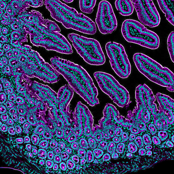 A 20X immunohistochemistry of murine small intestine embedded in paraffin by Marta Sanz and Carles Moreno Soriano