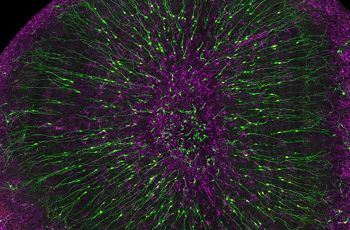 Purple and green olfactory bulb interneurons and astrocytes in the brain