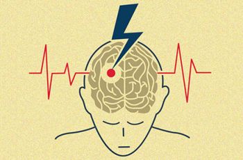 A see-through view into a person's head where a lightning bolt strikes part of their brain