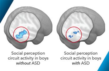 Two brain diagrams showing a higher social perception circuit activity in boys without ASD versus those with ASD