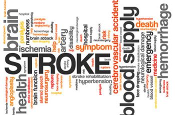 A word cloud with the largest words including 'Stroke', 'brain', 'blood supply' and 'hemorrhage' among many others