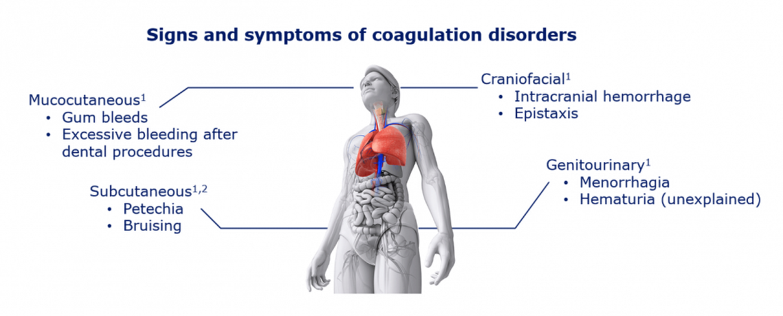 diagram of the signs and symptoms of coagulation disorders
