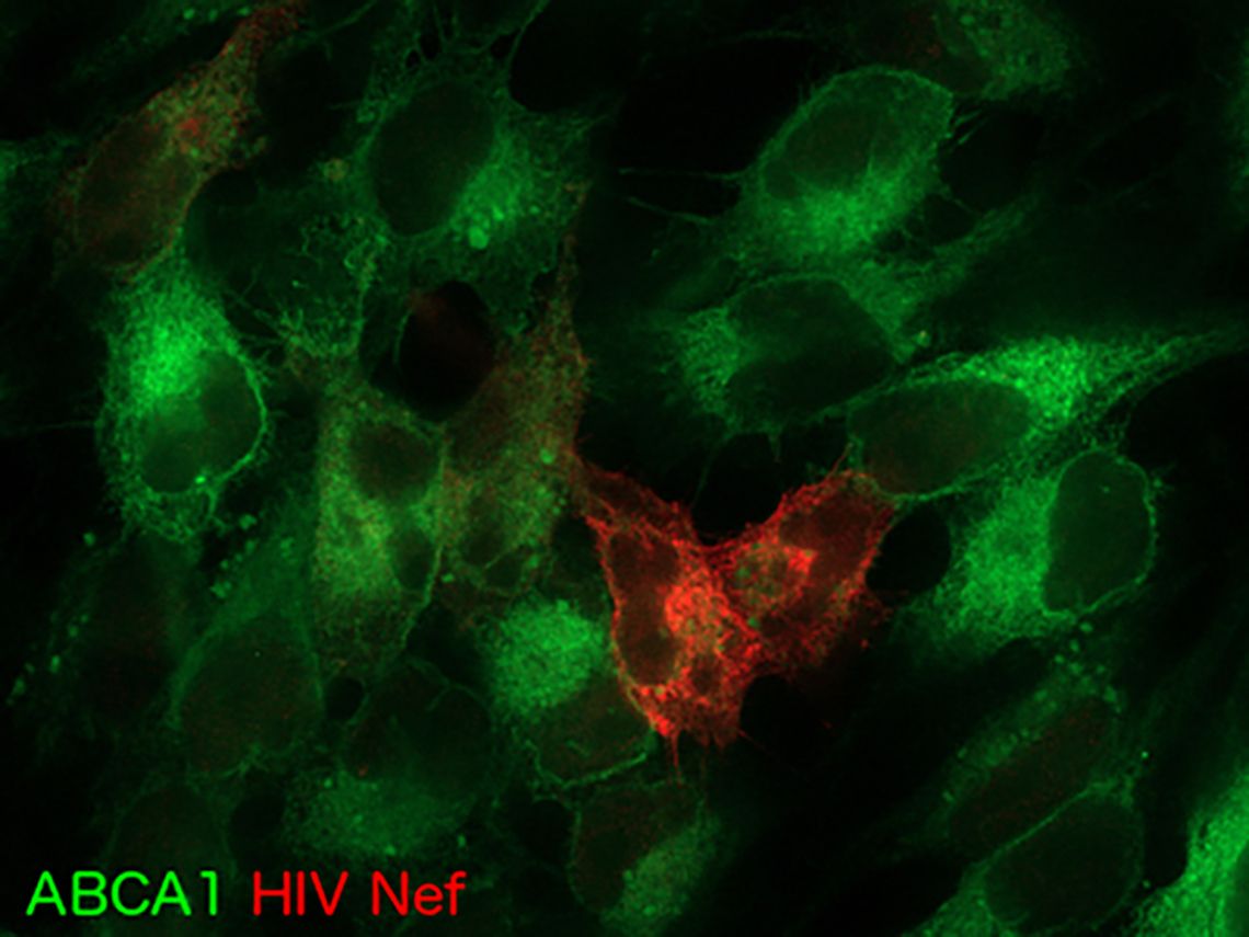 ABCA1 HIV Nef