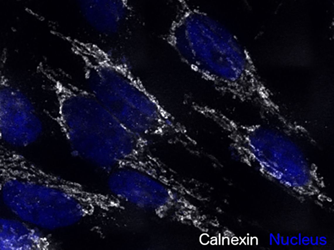 Calnexin Nucleus