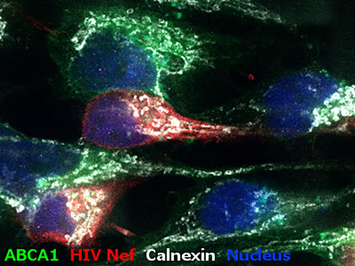 ABCA1 HIV Nef Nucleus Calnexin