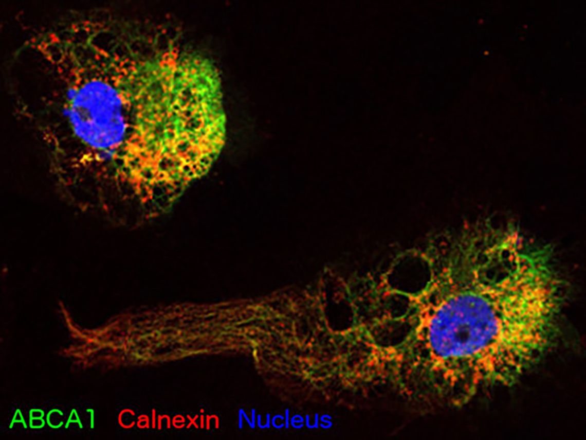 ABCA 1 Calnexin Nucleus 