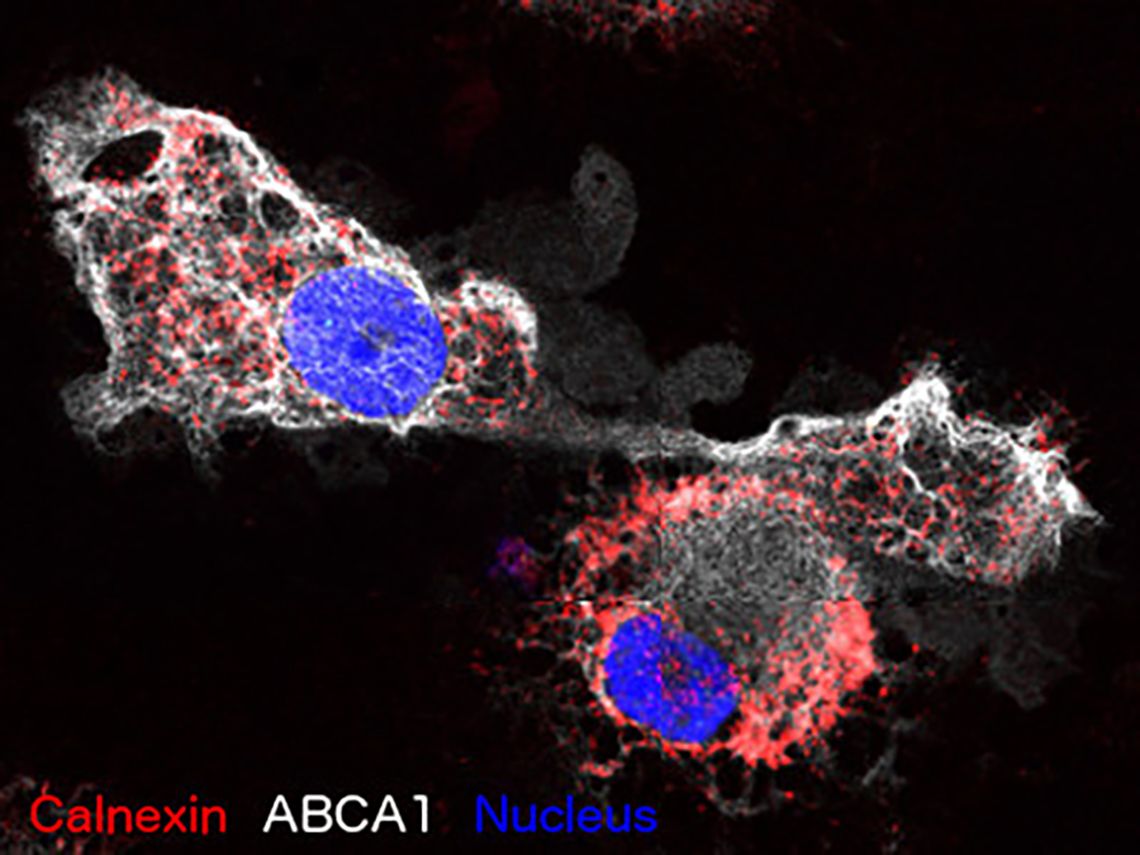 Calnexin ABCA 1 Nucleus 