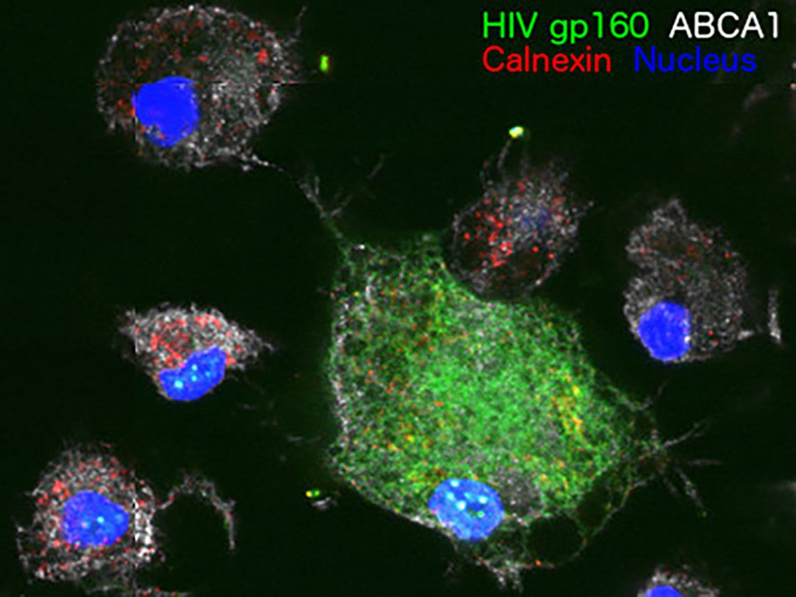 HIV gp 160 ABCA 1 Calnexin Nucleus 