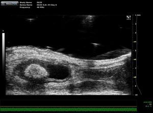 ultrasound-fig-s1