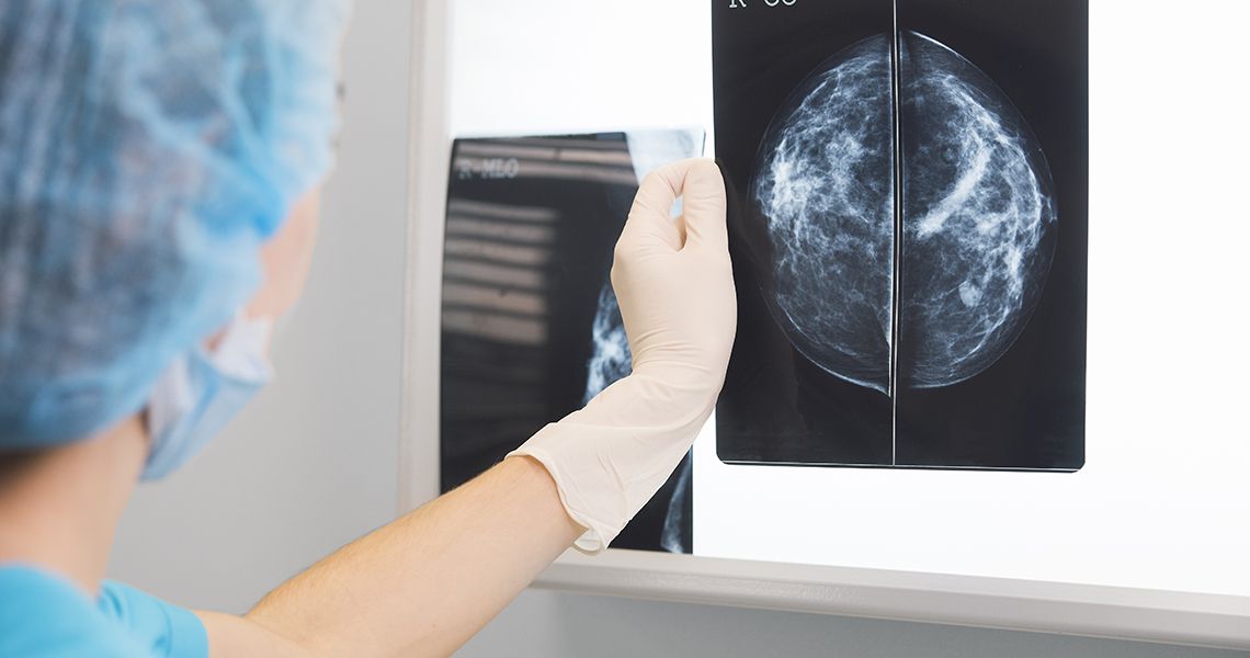 Doctor looking at breast scan
